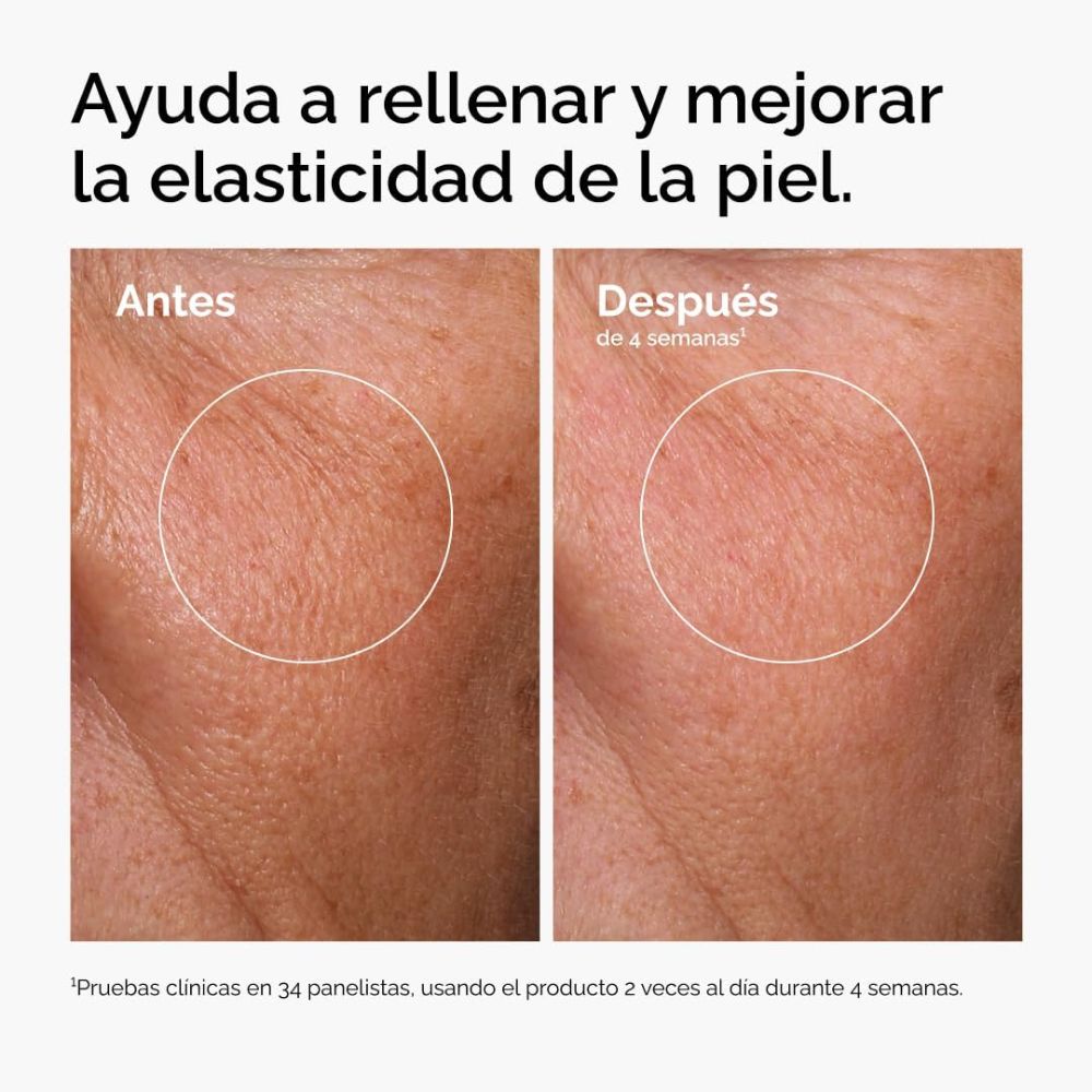 &Aacute;CIDO HIALUR&Oacute;NICO 2%+B5 Y CERAMIDAS S&Eacute;RUM (S&Eacute;RUM HIDRATANTE FACIAL)